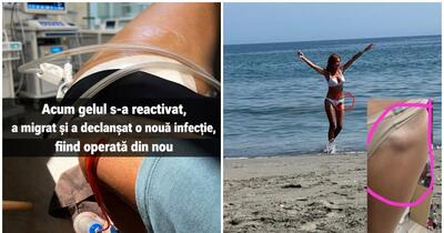 Coșmarul Aquafilling: Avertismentul unei avocate cu 30 de operații și un stimulator cardiac