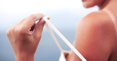 Arsurile solare severe pot dubla riscul de melanom: Ce spun dermatologii