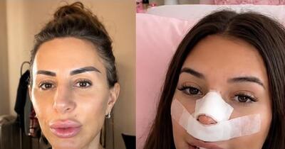 Influencerița care și-a făcut rinoplastie pentru ca viitorii săi copii „să nu îi moștenească nasul”. Ideea a primit replici pe măsură: „La o operație pe creier te-ai gândit?”