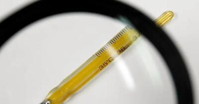 A trăit 20 de ani cu un termometru cu mercur în corp de frica părinților